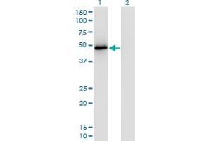 Western Blot analysis of TRAF2 expression in transfected 293T cell line by TRAF2 monoclonal antibody (M04A), clone 4C11. (TRAF2 Antikörper  (AA 1-501))