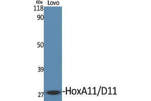 Western Blotting (WB) image for anti-Homeobox A11/D11 (HOXA11 + HOXD11) (C-Term) antibody (ABIN3175529) (HOXA11/D11 Antikörper  (C-Term))