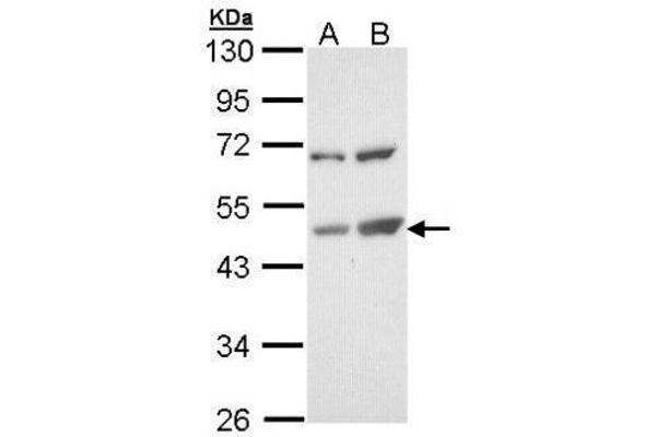 TSPYL1 Antikörper