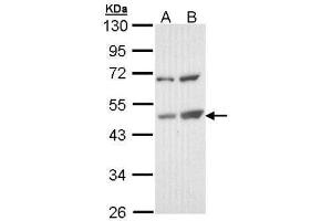 WB Image Sample (30 ug of whole cell lysate) A: Molt-4 , B: Raji 10% SDS PAGE antibody diluted at 1:1000 (TSPYL1 Antikörper)