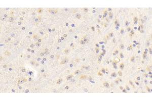 Immunohistochemistry (IHC) image for anti-Insulin-Like Growth Factor 1 (IGF1) (AA 49-153) antibody (ABIN7440332)