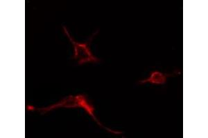 ABIN6274580 staining COLO205 cells by IF/ICC.
