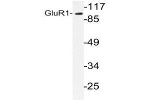 Western blot analysis of GluR1 antibody in extracts from COS-7 cells. (Glutamate Receptor 1 Antikörper)