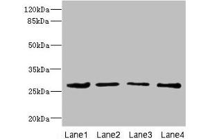 Western blot All lanes: DCXR antibody at 2. (DCXR Antikörper  (AA 1-244))