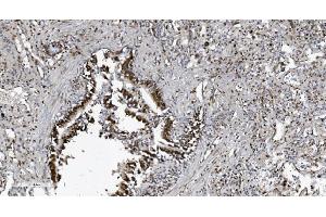 IHC analysis of SAMHD1 using anti-SAMHD1 antibody (ABIN7601514). (SAMHD1 Antikörper  (AA 37-626))