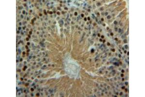 Used in DAB staining on fromalin fixed paraffin-embedded testis tissue (BLMH Antikörper  (AA 30-165))