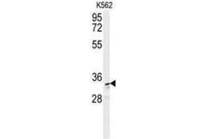 Western Blotting (WB) image for anti-Aldo-Keto Reductase Family 1, Member C3 (3-alpha Hydroxysteroid Dehydrogenase, Type II) (AKR1C3) (AA 17-44), (N-Term) antibody (ABIN950322)