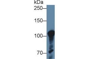 Detection of ABCF1 in Human K562 cell lysate using Polyclonal Antibody to ATP Binding Cassette Transporter F1 (ABCF1)