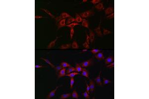 Immunofluorescence analysis of NIH/3T3 cells using  Rabbit pAb (ABIN7265789) at dilution of 1:50 (40x lens). (ATG12 Antikörper  (AA 1-74))