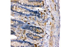 Immunohistochemistry (IHC) image for anti-Potassium Large Conductance Calcium-Activated Channel, Subfamily M, alpha Member 1 (KCNMA1) (AA 124-467) antibody (ABIN3043867)