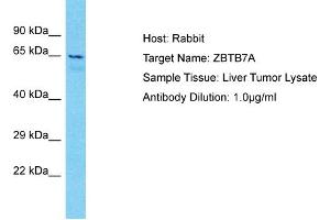 Host: Rabbit Target Name: ZBTB7A Sample Type: Liver Tumor lysates Antibody Dilution: 1.