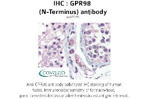 Image no. 2 for anti-G Protein-Coupled Receptor 98 (Gpr98) (Extracellular Domain), (N-Term) antibody (ABIN1735203) (Gpr98 Antikörper  (Extracellular Domain, N-Term))