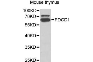Western blot analysis of extracts of mouse thymus, using PDCD1 antibody (ABIN5973254) at 1/1000 dilution. (PD-1 Antikörper)