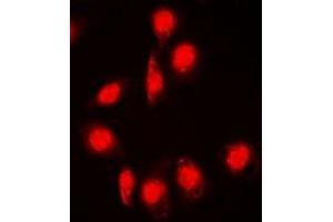Immunofluorescent analysis of DPF2 staining in Jurkat cells.