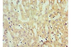 Immunohistochemistry of paraffin-embedded human liver tissue using ABIN7154755 at dilution of 1:100 (Nucleostemin Antikörper  (AA 1-240))