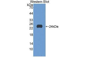 Western blot analysis of the recombinant protein. (GAA Antikörper  (AA 70-245))