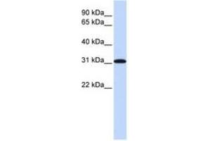 Image no. 1 for anti-Replication Protein A4, 30kDa (RPA4) (AA 180-229) antibody (ABIN6743785)