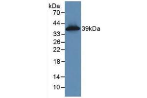 WB of Protein Standard: different control antibodies against Highly purified E. (KRT16 ELISA Kit)