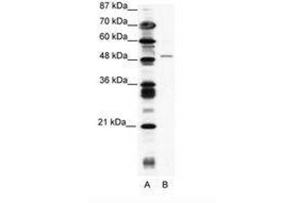 ZNF627 Antikörper  (AA 44-93)