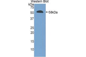 Western blot analysis of the recombinant protein. (GZMM Antikörper  (AA 19-251))
