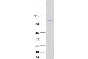 Western Blotting (WB) image for Amyloid beta (A4) Precursor Protein-Binding, Family A, Member 3 (APBA3) protein (Myc-DYKDDDDK Tag) (ABIN2714773)