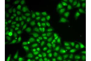 Immunofluorescence analysis of A549 cells using FEN1 antibody (ABIN5970521). (FEN1 Antikörper)