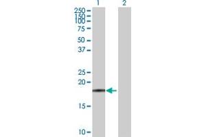 Western Blot analysis of FTL expression in transfected 293T cell line by FTL MaxPab polyclonal antibody. (FTL Antikörper  (AA 1-175))