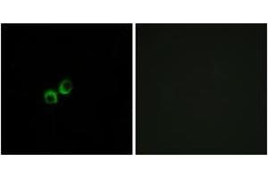Immunofluorescence analysis of MCF7 cells, using TAS1R3 Antibody.
