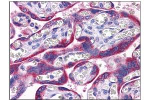 Human Placenta: Formalin-Fixed, Paraffin-Embedded (FFPE) (PAPPA2 Antikörper  (N-Term))