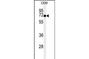 Western blot analysis of MFSD6 Antibody in CEM cell line lysates (35ug/lane) (MFSD6 Antikörper  (C-Term))