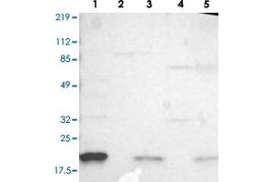 Western blot analysis of Lane 1: RT-4, Lane 2: U-251 MG, Lane 3: A-431, Lane 4: Liver, Lane 5: Tonsil with IL1RN polyclonal antibody . (IL1RN Antikörper)