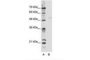 Image no. 1 for anti-Transcription Factor EB (TFEB) (C-Term) antibody (ABIN202620) (TFEB Antikörper  (C-Term))