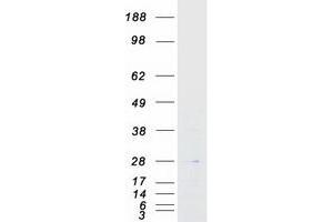 Validation with Western Blot (AKIP1 Protein (Transcript Variant 2) (Myc-DYKDDDDK Tag))