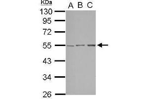 WB Image Sample (30 ug of whole cell lysate) A: A549 B: HepG2 C: HCT116 10% SDS PAGE antibody diluted at 1:1000 (STK38L Antikörper)