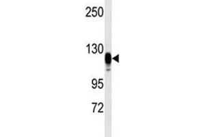 Western blot analysis of EGF Receptor antibody and kidney heart tissue lysate (EGFR Antikörper  (AA 1048-1077))