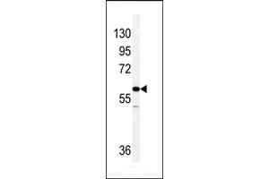 Western blot analysis of Vimentin antibody in NCI-H460 cell line lysates (35ug/lane). (Vimentin Antikörper  (C-Term))