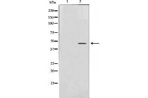 Western blot analysis on COLO205 cell lysate using AP-2 Antibody,The lane on the left is treated with the antigen-specific peptide. (TFAP2A Antikörper)