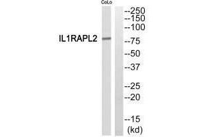 Western blot analysis of extracts from COLO205 cells, using IL1RAPL2 antibody. (IL1RAPL2 Antikörper)