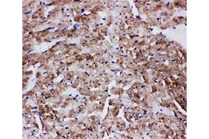 Immunohistochemistry (IHC) image for anti-Solute Carrier Family 2 (Facilitated Glucose Transporter), Member 4 (SLC2A4) (AA 491-509) antibody (ABIN3032677)