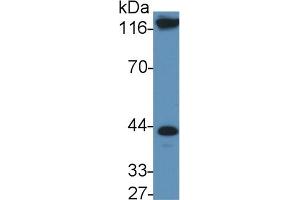 Detection of IL11Ra in Rat Serum using Polyclonal Antibody to Interleukin 11 Receptor Alpha (IL11Ra) (IL11RA Antikörper  (AA 194-329))