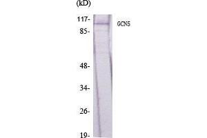 Western Blot (WB) analysis of specific cells using GCN5 Polyclonal Antibody. (KAT2A Antikörper  (C-Term))
