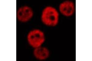 ABIN6277019 staining  Hela cells by IF/ICC. (RPS19 Antikörper  (Internal Region))