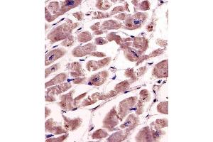 (ABIN391346 and ABIN2841367) staining SPHK1 in human heart tissue sections by Immunohistochemistry (IHC-P - paraformaldehyde-fixed, paraffin-embedded sections). (SPHK1 Antikörper  (AA 286-315))