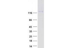 MKL2 Protein (Myc-DYKDDDDK Tag)