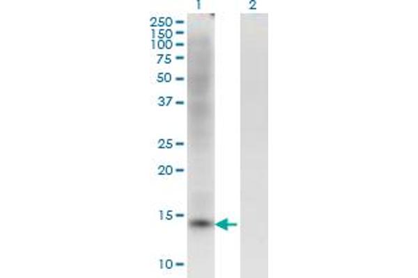 ZBTB16 抗体  (AA 381-480)