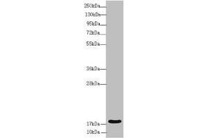 Western blot All lanes: RNF5 antibody at 3. (RNF5 Antikörper  (AA 1-120))