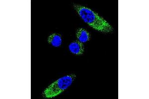 Confocal immunofluorescent analysis of CYP1A1 Antibody (Center) (ABIN392527 and ABIN2842082) with MDA-M cell followed by Alexa Fluor 488-conjugated goat anti-rabbit lgG (green). (CYP1A1 Antikörper  (AA 252-280))