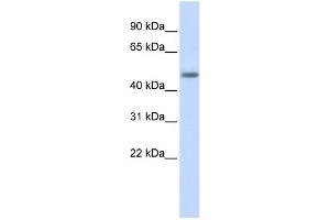 WB Suggested Anti-LASS5 Antibody Titration:  0. (LASS5 Antikörper  (N-Term))