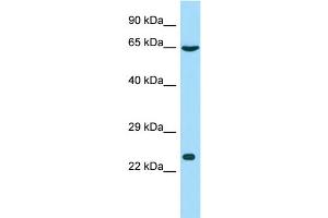 Host: Rabbit Target Name: GSTCD Sample Type: Hela Whole cell lysates Antibody Dilution: 1. (GSTCD Antikörper  (N-Term))