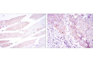 Immunohistochemistry (IHC) image for anti-Bone Morphogenetic Protein Receptor, Type II (serine/threonine Kinase) (BMPR2) antibody (ABIN968988)